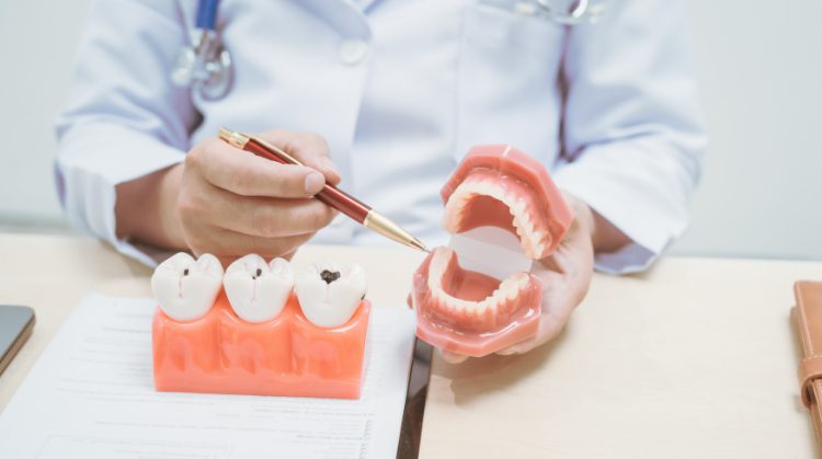 Dentist at Palo Verde Smiles in Glendale, AZ explaining cavity prevention and treatment using tooth and jaw models.